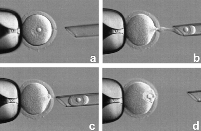 ĴԹӤ (Cytoplasm Transfer)