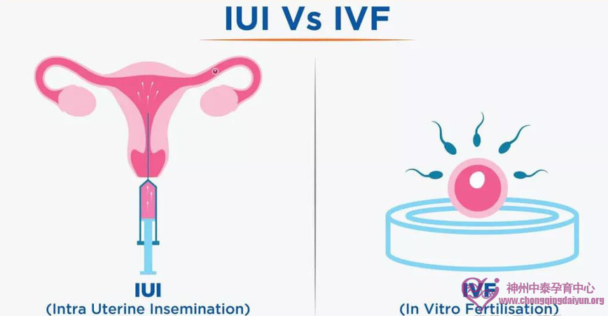 人工授精IUI和美国试管婴儿IVF，我应该如何选择？
