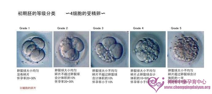 试管婴儿胚胎移植必须要符合哪些条件?