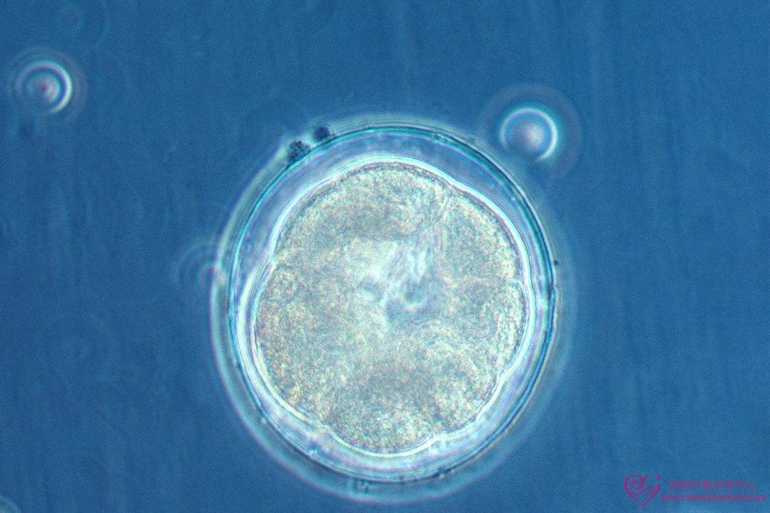 “冻胚”与“鲜胚”，试管婴儿过程中究竟移植哪个好？
